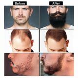 5Pcs Beard Growth Kit
